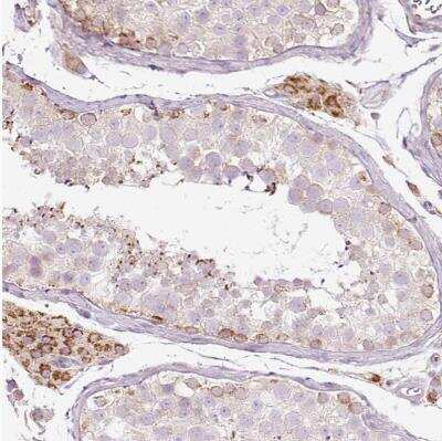 Immunohistochemistry-Paraffin: PAQR9 Antibody [NBP2-30402]