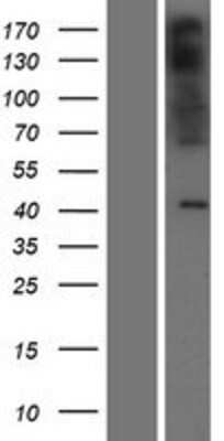 Western Blot: PAQR9 Overexpression Lysate [NBP2-04689]