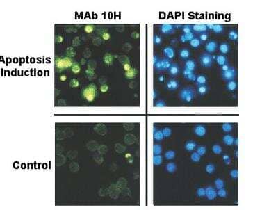 Immunocytochemistry/ Immunofluorescence: PAR/pADPr Antibody (10H) [NBP2-89039]