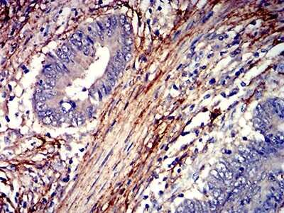 Immunohistochemistry: PAR1/Thrombin Receptor Antibody (5E2E6) - BSA Free [NBP2-61770]
