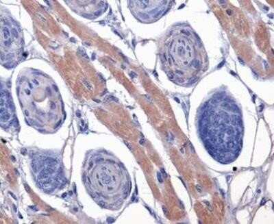 Immunohistochemistry: PAR1/Thrombin Receptor Antibody (N2-11) - Azide and BSA Free [NBP2-80904]