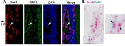 Immunohistochemistry: PAR1/Thrombin Receptor Antibody (N2-11) [NBP1-71770]