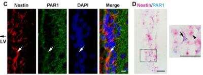 Immunohistochemistry: PAR1/Thrombin Receptor Antibody (N2-11) [NBP1-71770]