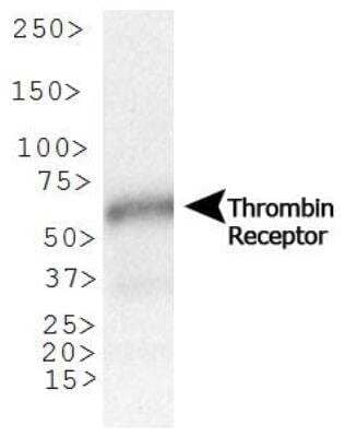Western Blot: PAR1/Thrombin Receptor Antibody (N2-11) [NBP1-71770]