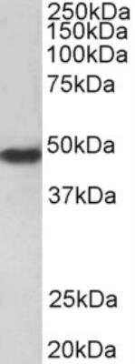 Western Blot: PAR1/Thrombin Receptor Antibody [NBP1-51936]