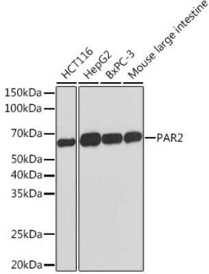 Western Blot: PAR2 Antibody (9X8E6) [NBP3-16555]