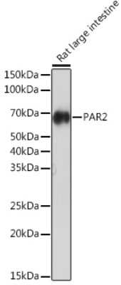 Western Blot: PAR2 Antibody (9X8E6) [NBP3-16555]