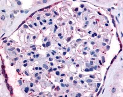 Immunohistochemistry-Paraffin: PAR2 Antibody - BSA Free [NBP1-44306]