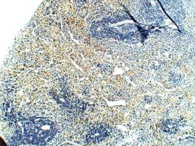 Immunohistochemistry-Paraffin: PAR2 Antibody [NBP2-11250]