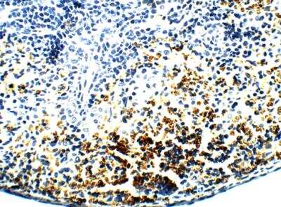 Immunohistochemistry-Paraffin: PAR2 Antibody [NBP2-11250]
