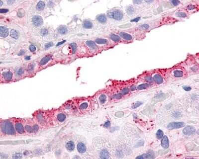 Immunohistochemistry-Paraffin: PAR2 Antibody - BSA Free [NLS252]