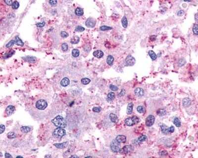 Immunohistochemistry-Paraffin: PAR2 Antibody - BSA Free [NLS252]
