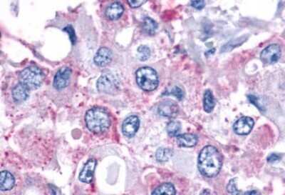 Immunohistochemistry-Paraffin: PAR2 Antibody - BSA Free [NLS252]