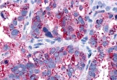 Immunohistochemistry-Paraffin: PAR2 Antibody - BSA Free [NLS252]