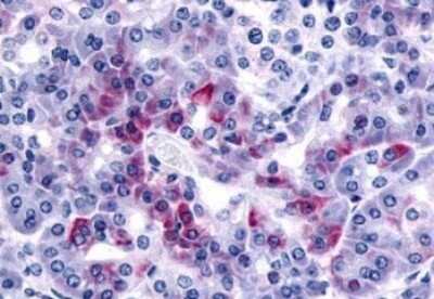 Immunohistochemistry-Paraffin: PAR2 Antibody - BSA Free [NLS252]