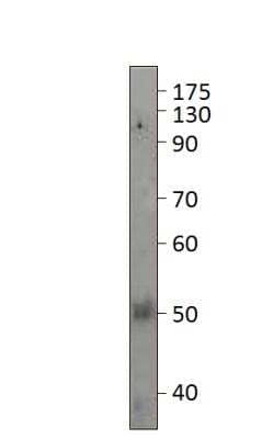 Western Blot: PAR2 Antibody [NBP2-11250]