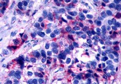 Immunohistochemistry-Paraffin: PAR3/Thrombin Receptor-like 2 Antibody [NLS261]