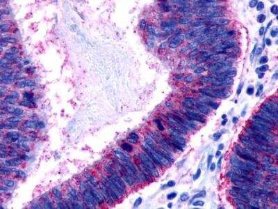 Immunohistochemistry-Paraffin: PAR3/Thrombin Receptor-like 2 Antibody [NLS261]