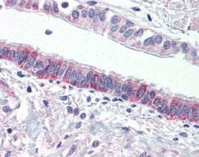 Immunohistochemistry-Paraffin: PAR4 Antibody - BSA Free [NLS1308]