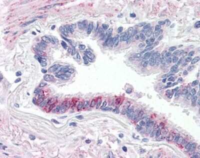 Immunohistochemistry-Paraffin: PAR4 Antibody - BSA Free [NLS1311]