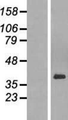 Western Blot: PARD6A Overexpression Lysate [NBL1-14102]