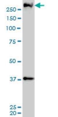 Western Blot: PARC Antibody (3F7) [H00023113-M01]