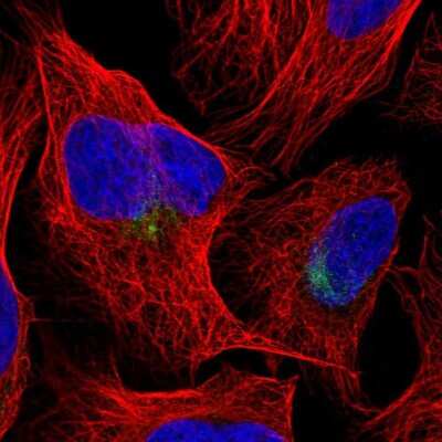 Immunocytochemistry/ Immunofluorescence: PARC Antibody [NBP2-58049]