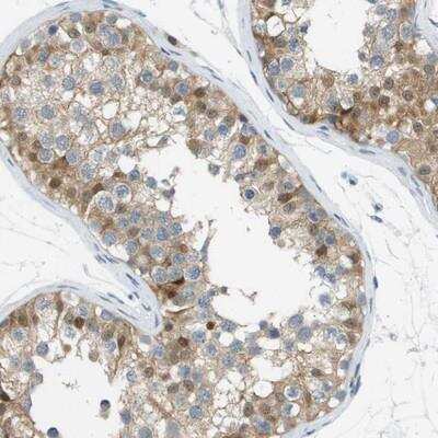 Immunohistochemistry: PARC Antibody [NBP1-92243]