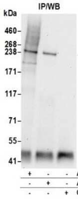 Immunoprecipitation: PARC Antibody [NB100-2300]