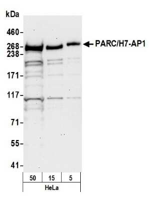 Western Blot: PARC Antibody [NB100-2300]