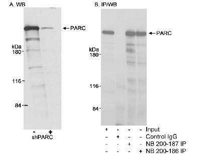 Western Blot: PARC Antibody [NB200-187]