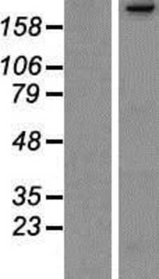 Western Blot: PARC Overexpression Lysate [NBP2-10299]