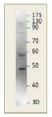 Western Blot: PARD3/Par3 Antibody [NBP2-11253]