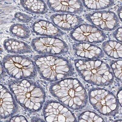 Immunohistochemistry-Paraffin: PARD3/Par3 Antibody [NBP1-88861]