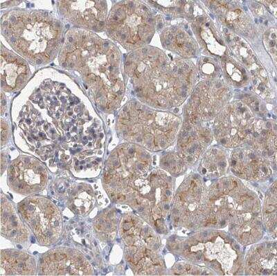 Immunohistochemistry-Paraffin: PARD3/Par3 Antibody [NBP1-88861]