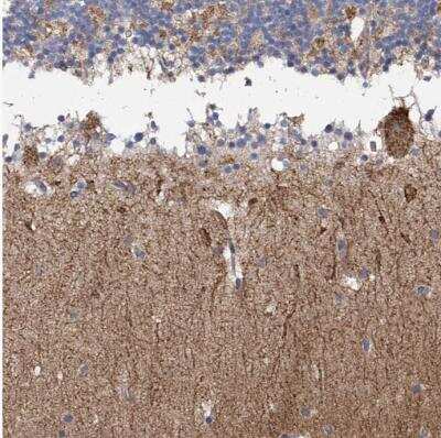Immunohistochemistry-Paraffin: PARD3/Par3 Antibody [NBP1-88861]