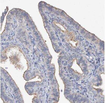 Immunohistochemistry-Paraffin: PARD3/Par3 Antibody [NBP1-88861]