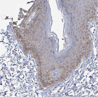 Immunohistochemistry-Paraffin: PARD3/Par3 Antibody [NBP1-88861]