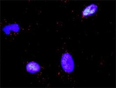 Proximity Ligation Assay: PARD3/Par3 Antibody [H00056288-D01P]