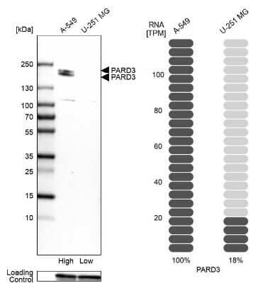 Western Blot: PARD3/Par3 Antibody [NBP1-88861]