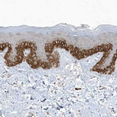 Immunohistochemistry-Paraffin: PARD3B Antibody [NBP1-89114]