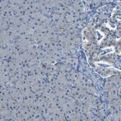 Immunohistochemistry-Paraffin: PARD6B Antibody [NBP1-87337]