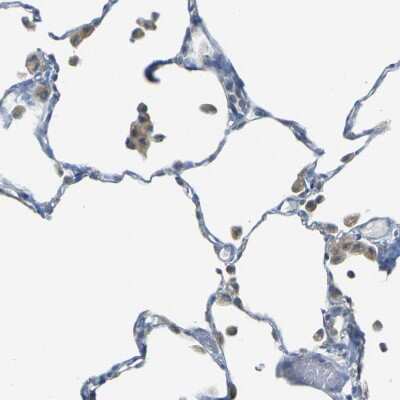 Immunohistochemistry-Paraffin: PARD6B Antibody [NBP1-87337]