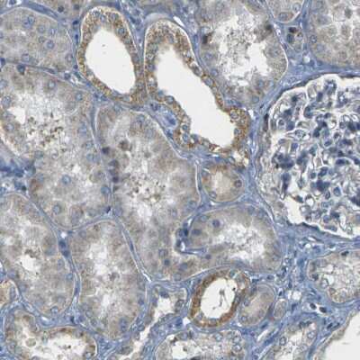 Immunohistochemistry-Paraffin: PARD6B Antibody [NBP1-87337]