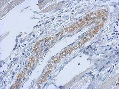 Immunohistochemistry-Paraffin: PARD6B Antibody [NBP2-19695]