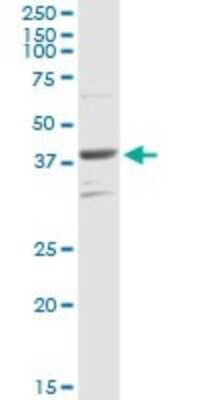 Western Blot: PARD6B Antibody [H00084612-D01P]