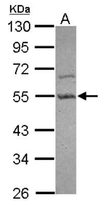 Western Blot: PARD6B Antibody [NBP2-19695]