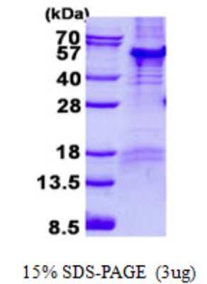 SDS-PAGE: Recombinant Human PARD6B His Protein [NBP2-23315]