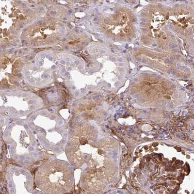 Immunohistochemistry-Paraffin: PARD6G Antibody [NBP2-30757]