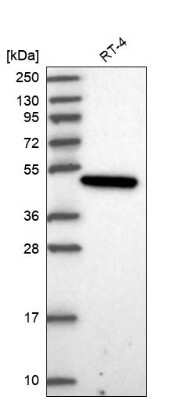 Western Blot: PARD6G Antibody [NBP2-30757]